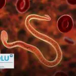 Attention aux parasites ! Repérez les signes de leur présence dans votre corp