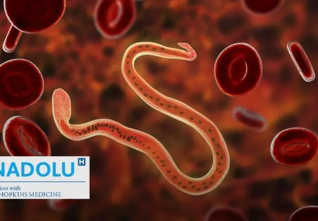 Attention aux parasites ! Repérez les signes de leur présence dans votre corp