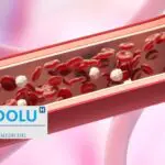 Angiographie : comprendre l’examen clé pour diagnostiquer et traiter les maladies cardiaques