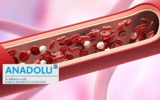 Angiographie : comprendre l’examen clé pour diagnostiquer et traiter les maladies cardiaques