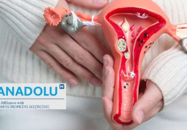 L’endométriose, une maladie chronique silencieuse qui bouleverse la vie de millions de femmes