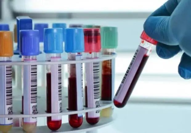 Analyses médicales en Algérie : le coup de pression du SALAM