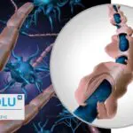 Sclérose en plaques (SEP) : causes, symptômes, évolution, traitement… le guide complet