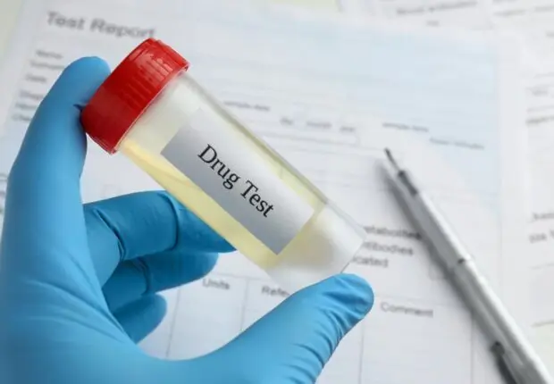 Nouvelle loi pour l’emploi en Algérie : le test anti-drogue devient obligatoire