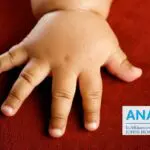 Prévenir et traiter l’obésité chez l’enfant : le guide complet