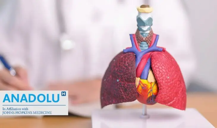 Cancer de la plèvre