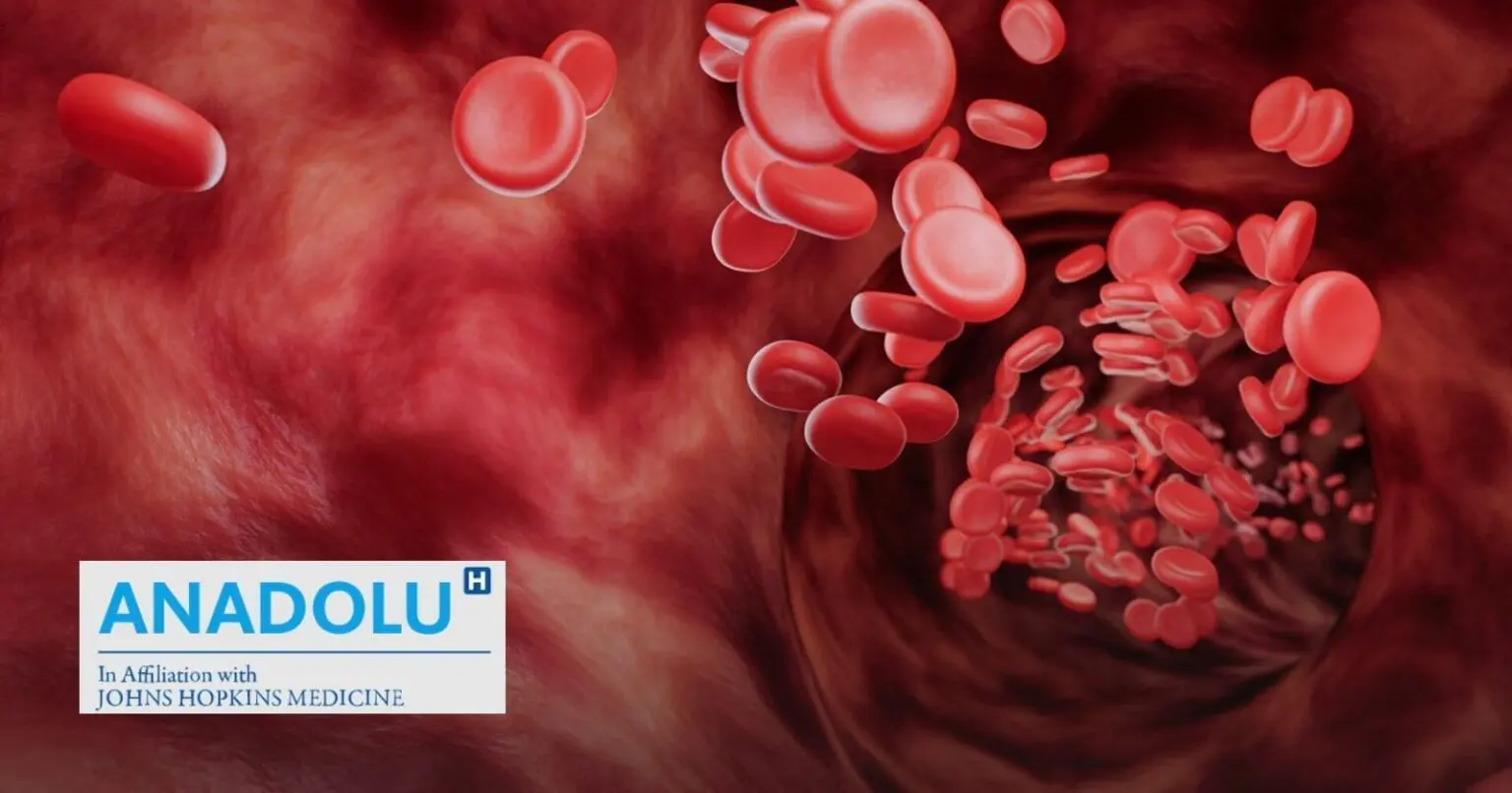 De l’hypovolémie au choc hypovolémique : repérer les signes d&rsquo;alerte et réagir vite