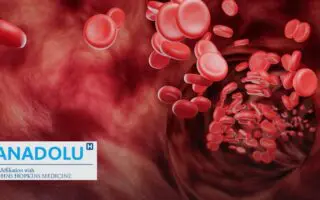 De l’hypovolémie au choc hypovolémique : repérer les signes d&rsquo;alerte et réagir vite