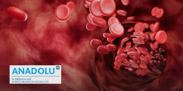 De l’hypovolémie au choc hypovolémique : repérer les signes d&rsquo;alerte et réagir vite