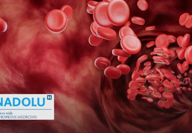 De l’hypovolémie au choc hypovolémique : repérer les signes d&rsquo;alerte et réagir vite