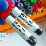 Comprendre les gènes BRCA : qui devrait se faire tester et pourquoi ?