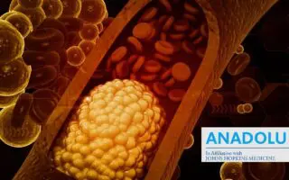 Vaincre le mauvais cholestérol : mode d’emploi pour nettoyer vos artères naturellement