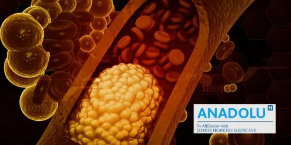 Vaincre le mauvais cholestérol : mode d’emploi pour nettoyer vos artères naturellement