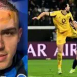 Visage balafré à cause de Bensebaini : l&rsquo;image de Krstovic enflamme la toile (vidéo)