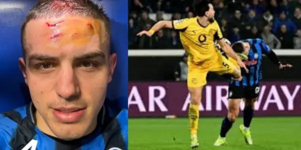 Visage balafré à cause de Bensebaini : l’image de Krstovic enflamme la toile (vidéo)