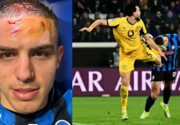 Visage balafré à cause de Bensebaini : l&rsquo;image de Krstovic enflamme la toile (vidéo)