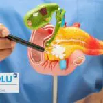 Cancer du pancréas : pourquoi ce « tueur silencieux » échappe-t-il encore au diagnostic précoce ?