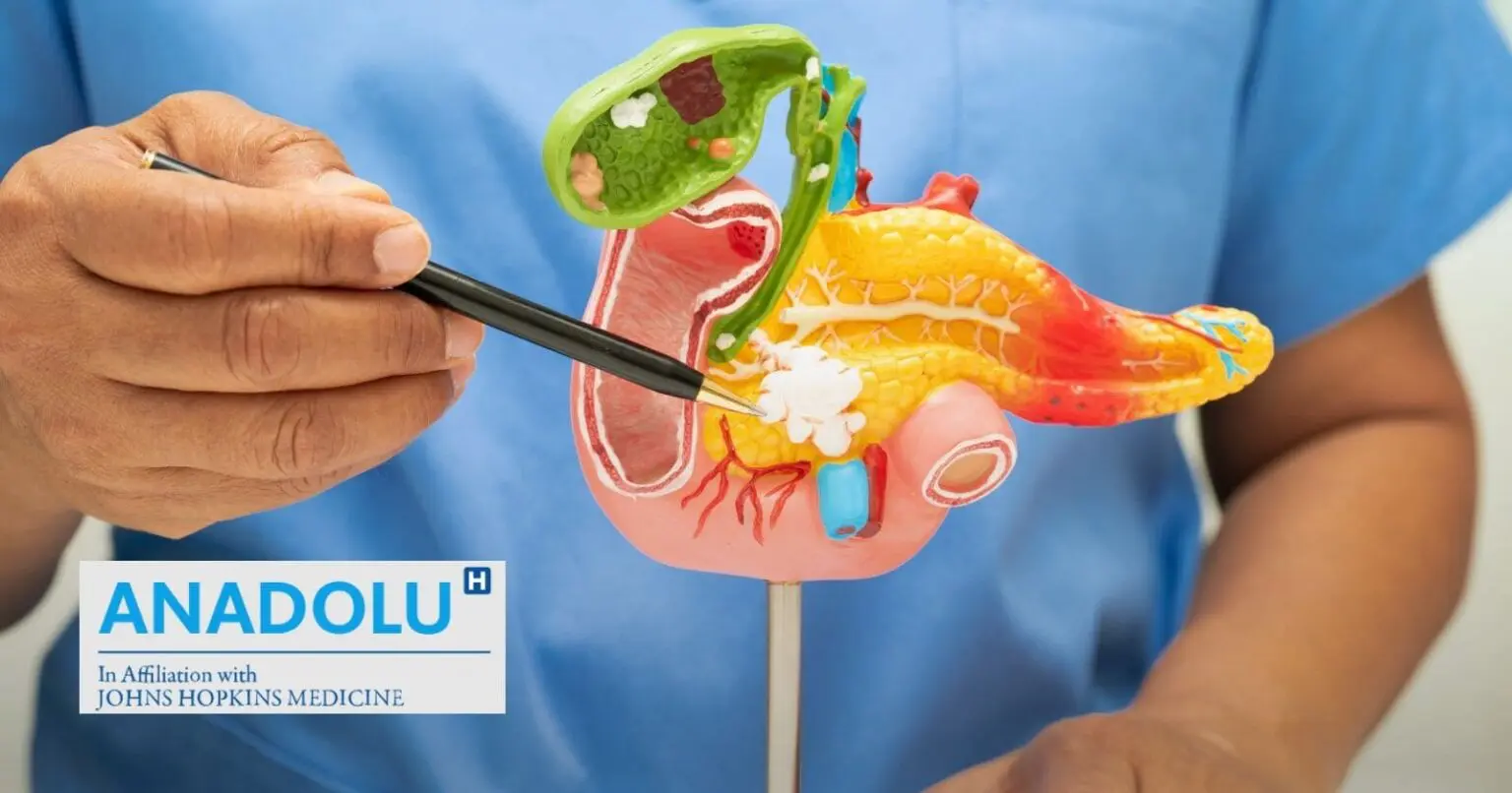 Cancer du pancréas : pourquoi ce « tueur silencieux » échappe-t-il encore au diagnostic précoce ?