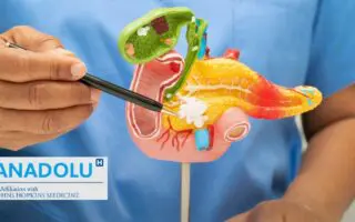 Cancer du pancréas : pourquoi ce « tueur silencieux » échappe-t-il encore au diagnostic précoce ?