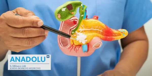 Cancer du pancréas : pourquoi ce « tueur silencieux » échappe-t-il encore au diagnostic précoce ?