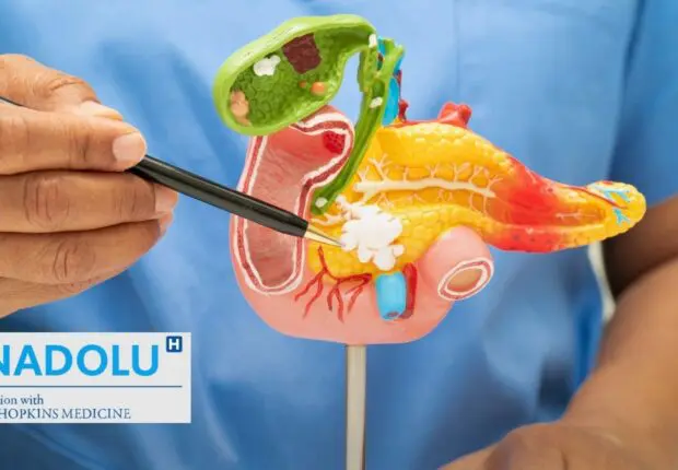 Cancer du pancréas : pourquoi ce « tueur silencieux » échappe-t-il encore au diagnostic précoce ?