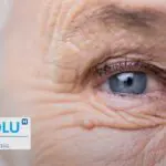 Comment reconnaître et traiter la dégénérescence maculaire (DMLA)