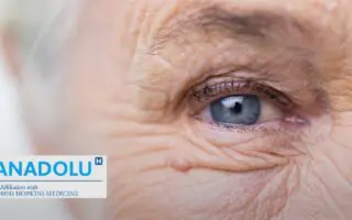 Comment reconnaître et traiter la dégénérescence maculaire (DMLA)