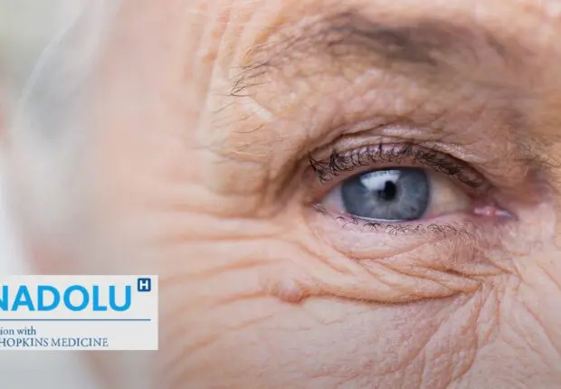 Comment reconnaître et traiter la dégénérescence maculaire (DMLA)