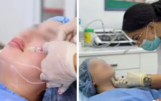 Injections, lasers et fillers : pourquoi la médecine esthétique ne s’improvise pas