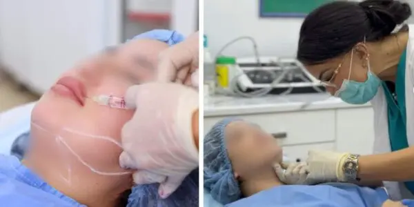 Injections, lasers et fillers : pourquoi la médecine esthétique ne s’improvise pas