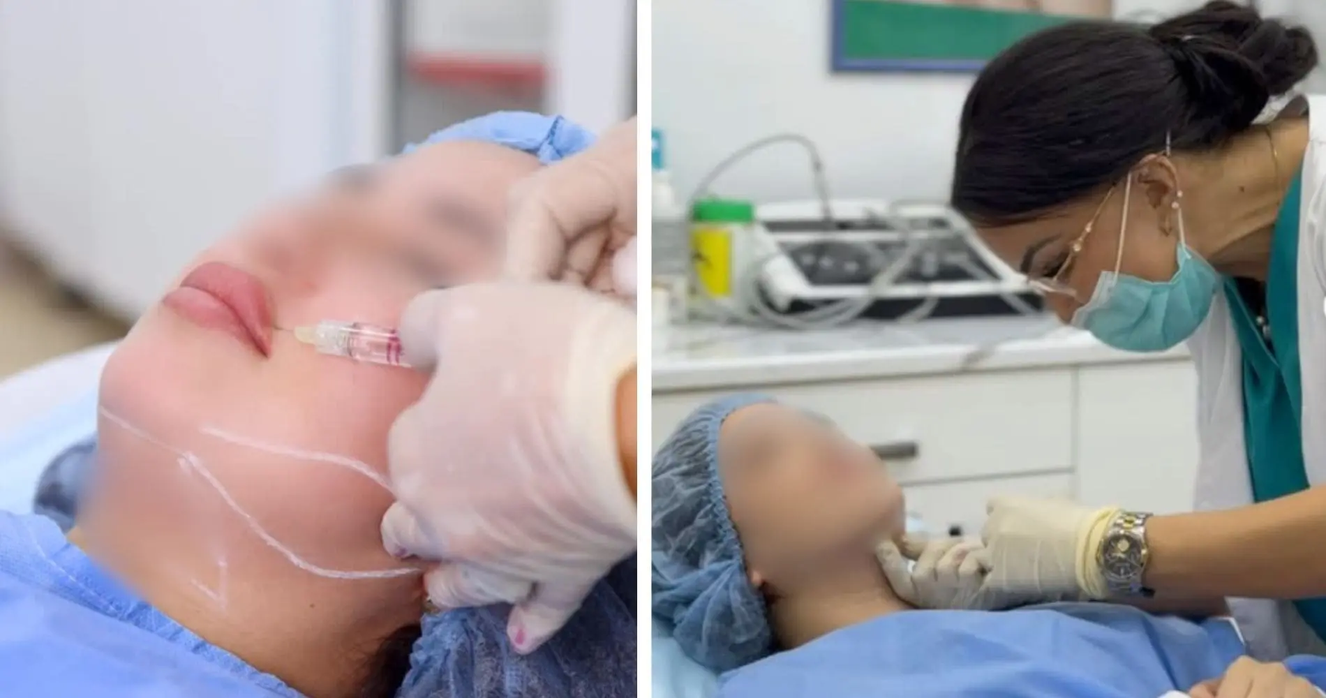 Injections, lasers et fillers : pourquoi la médecine esthétique ne s’improvise pas