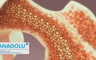 Myélome et leucémie : tout savoir sur les cancers de la moelle osseuse