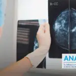 Du stade in situ à la forme invasive : décryptage des multiples formes du cancer du sein