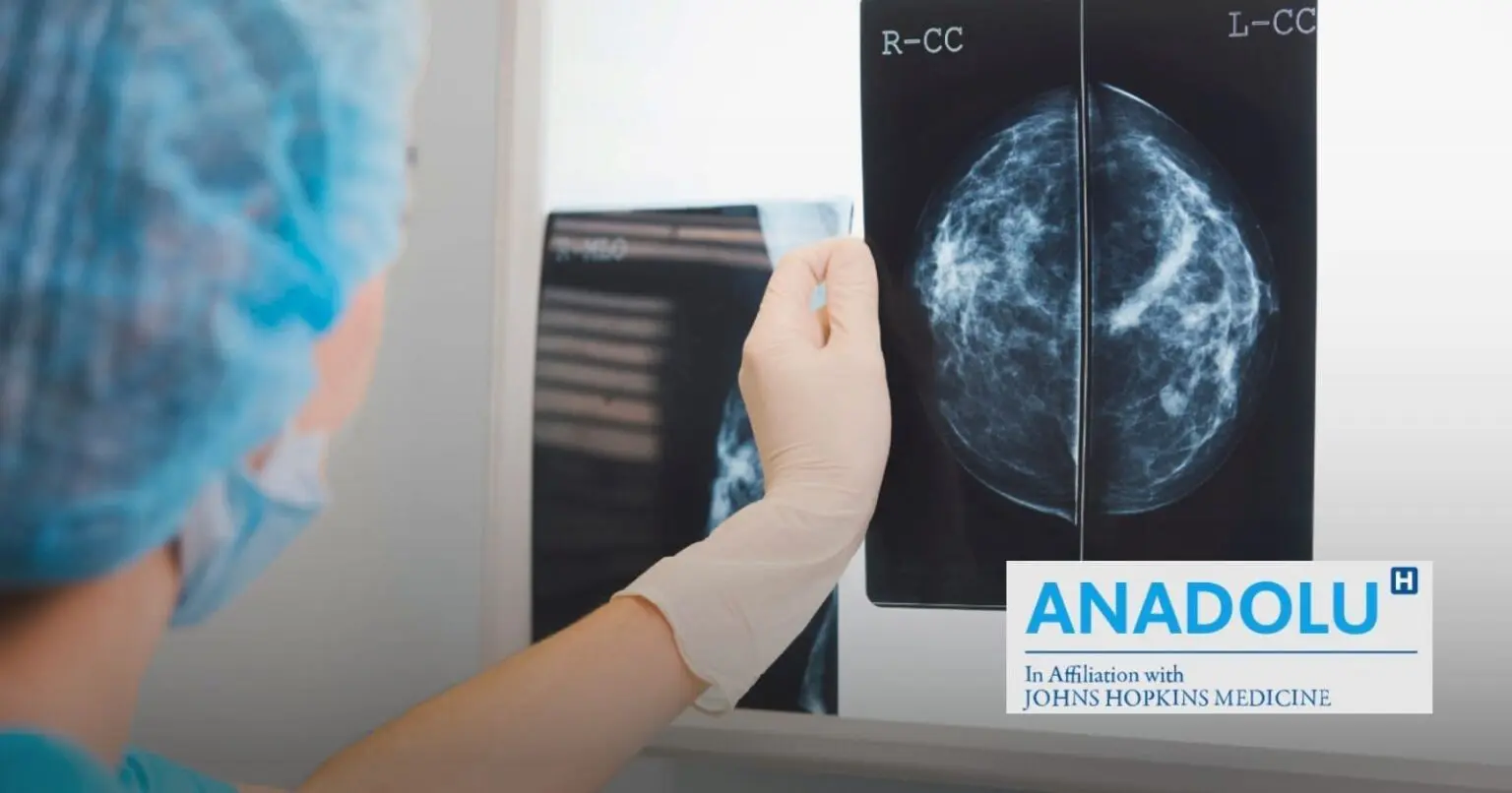 Du stade in situ à la forme invasive : décryptage des multiples formes du cancer du sein