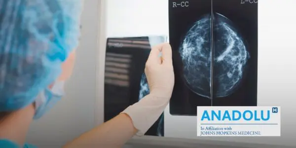 Du stade in situ à la forme invasive : décryptage des multiples formes du cancer du sein