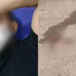 Oran : un enseignant violemment agressé par un élève, la blessure a nécessité 14 points de suture