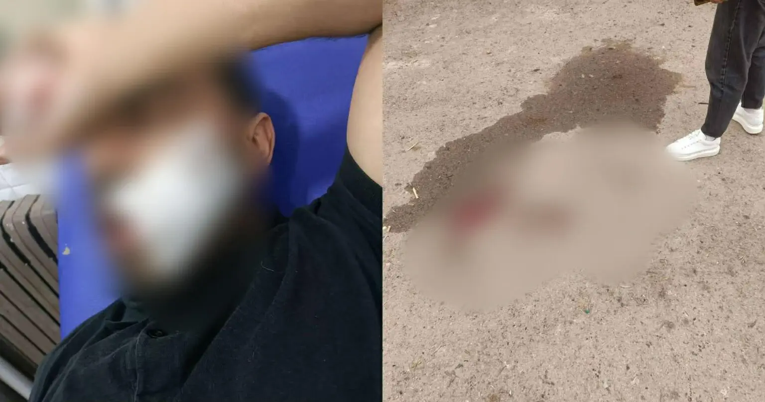 Oran : un enseignant violemment agressé par un élève, la blessure a nécessité 14 points de suture