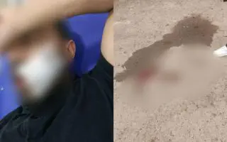 Oran : un enseignant violemment agressé par un élève, la blessure a nécessité 14 points de suture