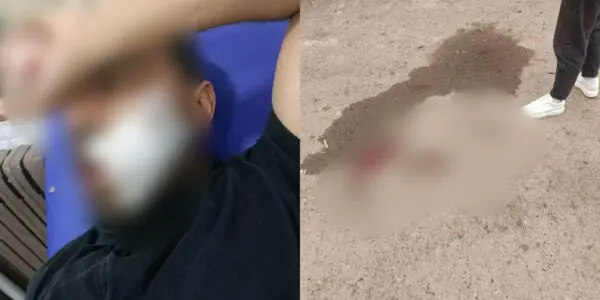 Oran : un enseignant violemment agressé par un élève, la blessure a nécessité 14 points de suture