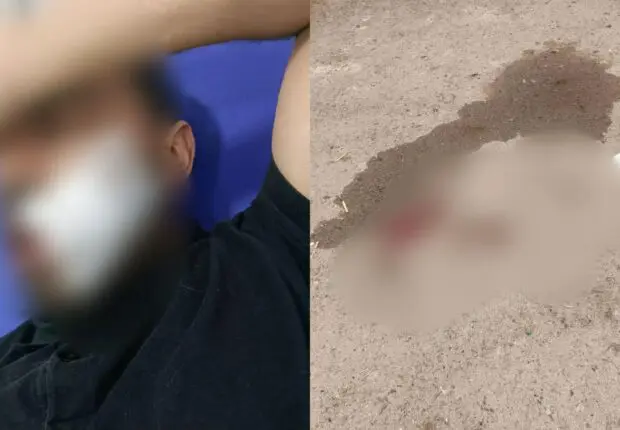 Oran : un enseignant violemment agressé par un élève, la blessure a nécessité 14 points de suture