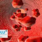 Anémie méditerranéenne (thalassémie) : décryptage d&rsquo;une maladie du sang