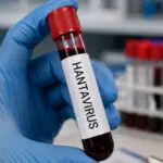 Hantavirus : faut-il s’inquiéter en Algérie ? Le ministère de la Santé répond