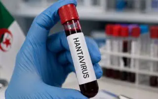 Hantavirus : faut-il s’inquiéter en Algérie ? Le ministère de la Santé répond