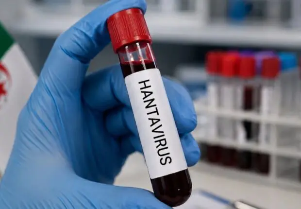 Hantavirus : faut-il s’inquiéter en Algérie ? Le ministère de la Santé répond