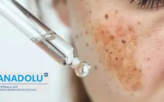 Hyperpigmentation de la peau : causes biologiques et solutions dermatologiques