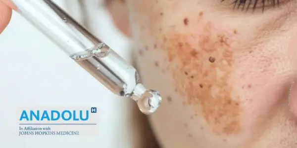 Hyperpigmentation de la peau : causes biologiques et solutions dermatologiques