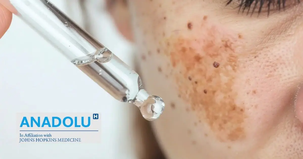 Hyperpigmentation de la peau : causes biologiques et solutions dermatologiques