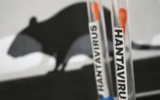 Hantavirus : un premier test positif et 22 cas contacts identifiés en France