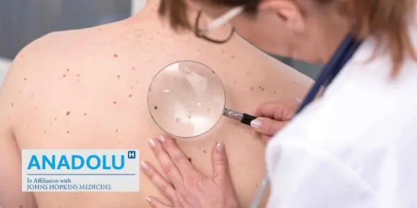 Face au cancer de la peau : Les avancées de la médecine et les traitements qui marchent