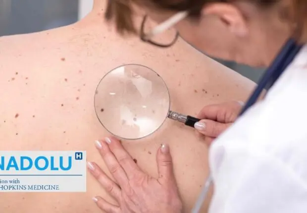 Face au cancer de la peau : Les avancées de la médecine et les traitements qui marchent